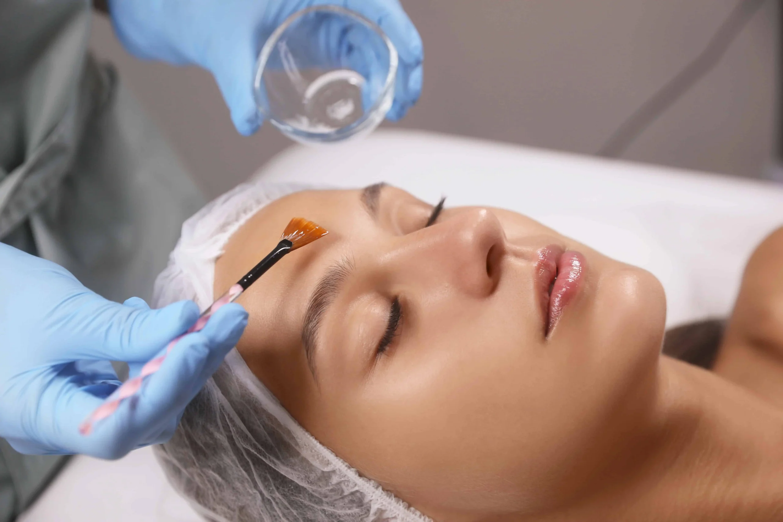 Chemical Peels in Union, KY | Elite Medspa