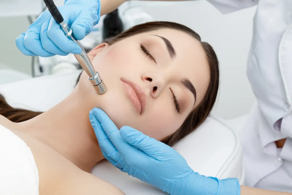 Microdermabrasion Treatment in Union, KY