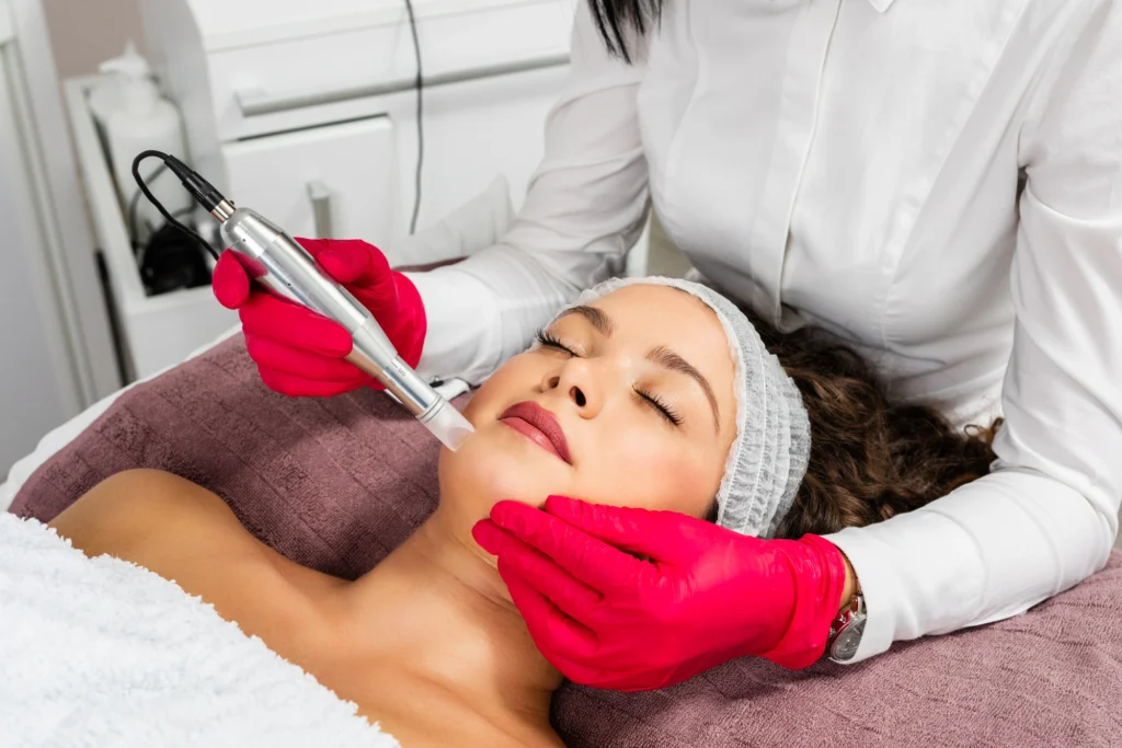 Microneedling Treatment In Union, KY | Elite Medspa