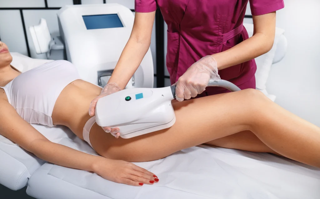CoolSculpting Fat removal Treatment